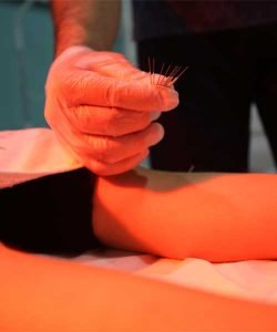 Akupunktur İğne Fiyatı Ne Kadar