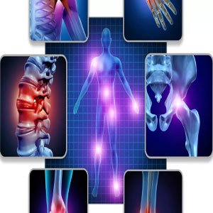 Romatolojik Hastalıklar Ve Rahatsızlıklar Nelerdir