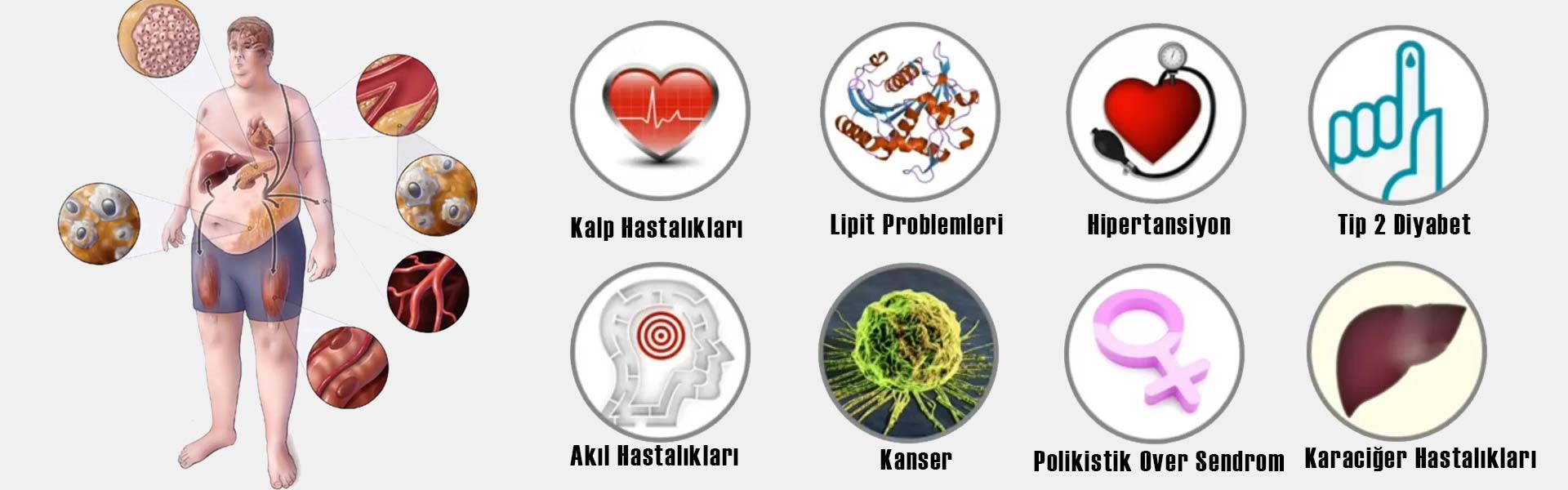 Endokrinoloji Ve Metabolizma Hastalıkları Tedavisi Konya