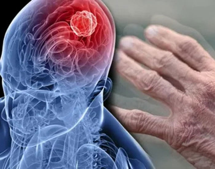 Genç Yaşta El Titremesi Nedenleri Ve Tedavisi Konya