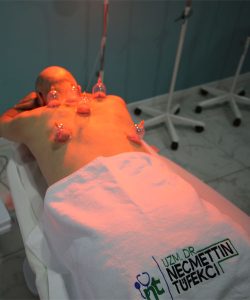 Hacamat Kur'an Da Geçiyor Mu İslamda Hacamat