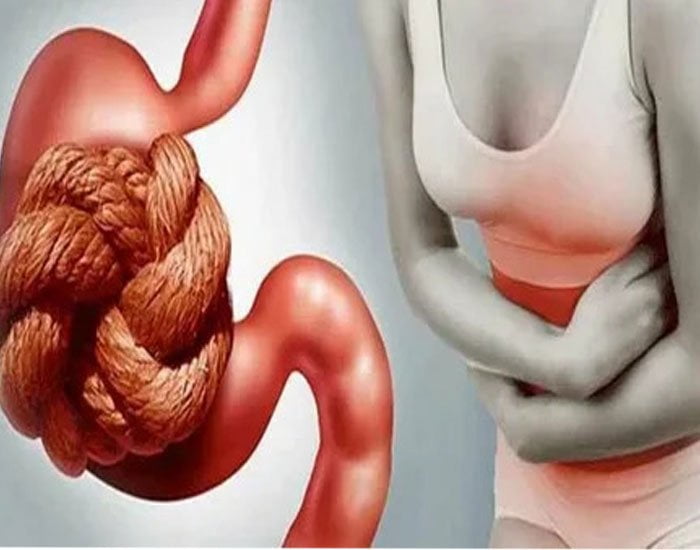 Kabızlık Belirtileri Ve Nedenleri