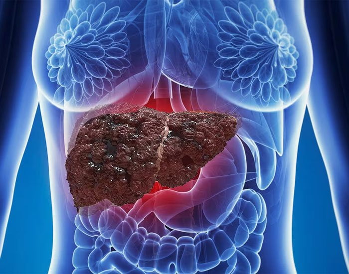 Konya Kronik Hepatit Tedavisi Doktorları