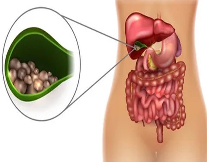 Konya Safra Kesesi Ameliyatı En İyi Doktor