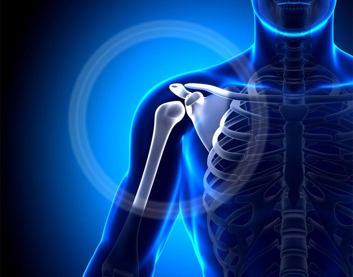 Omuz Yırtığı İğne Ve Sülük Tedavisi