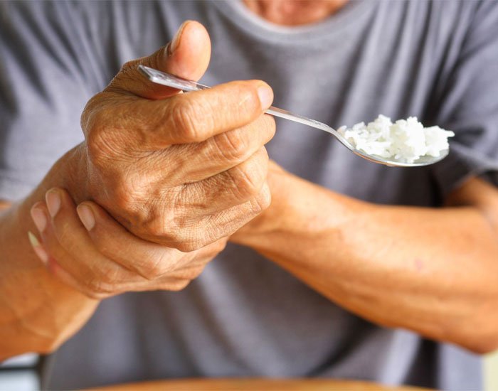 Parkinson Hastalığı Tedavisi Konya