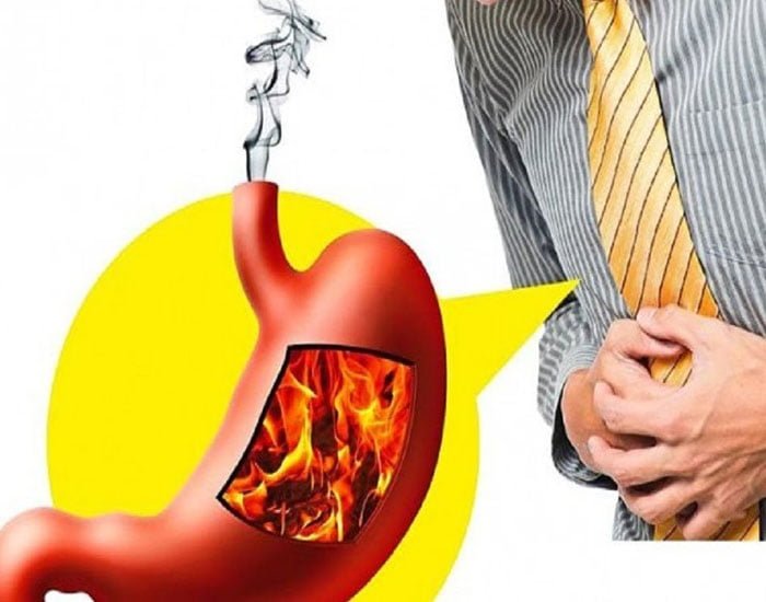 Reflü Tedavisi Ve İlaçları