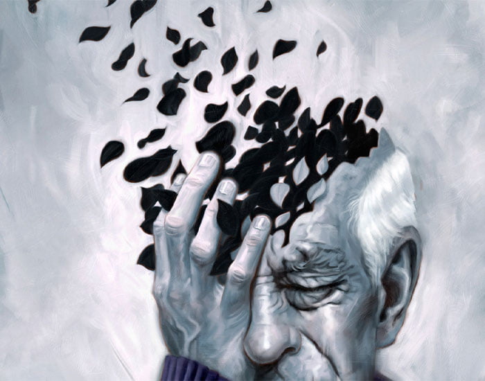 Alzheimer Kesin Çözüm ve Alzheimer Bitkisel Tedavisi