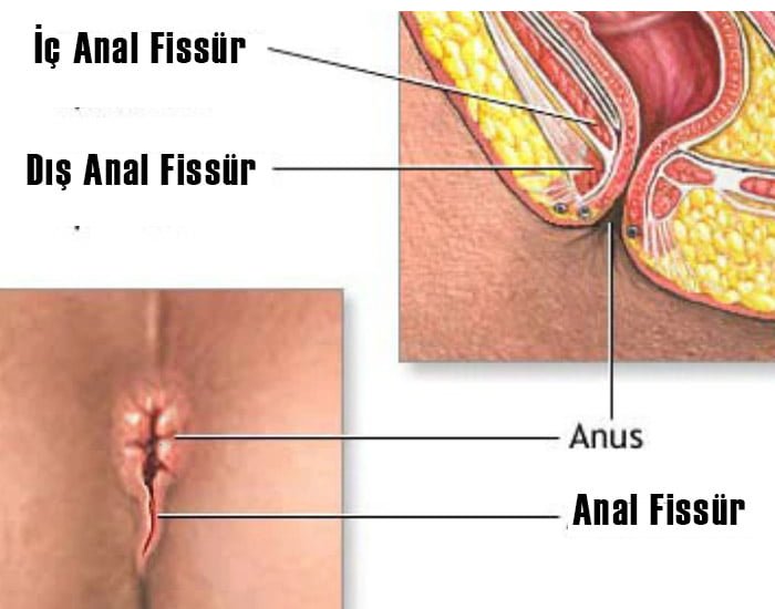 Yalangoch Jasmin Webb fotosuratlari Cl erotik erotik