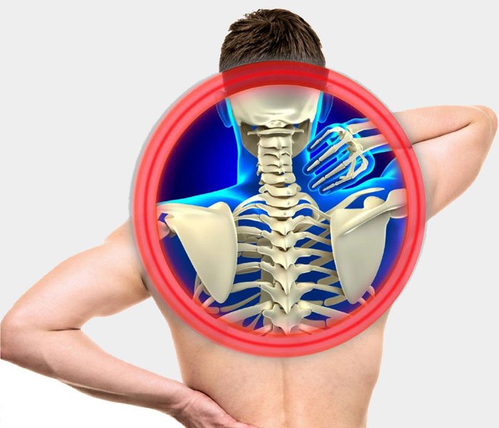 Boyun Fıtığı Tedavi Yöntemleri