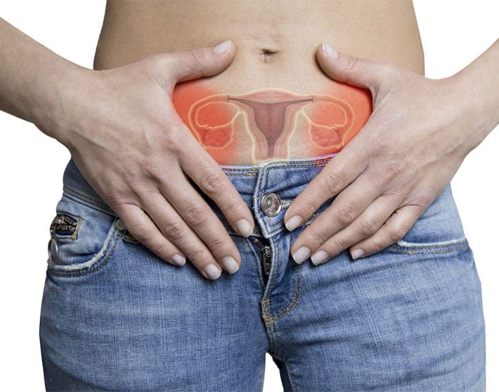 Çikolata Kisti Sülükve Hacamat Tedavisi