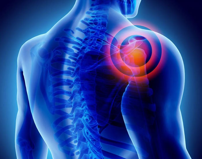 Donuk Omuz Prp Tedavisi Konya