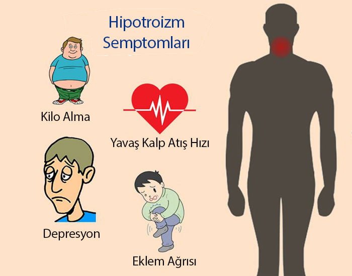 Hipotiroidi Belirtileri Ve Hipotiroidi Neden Olur