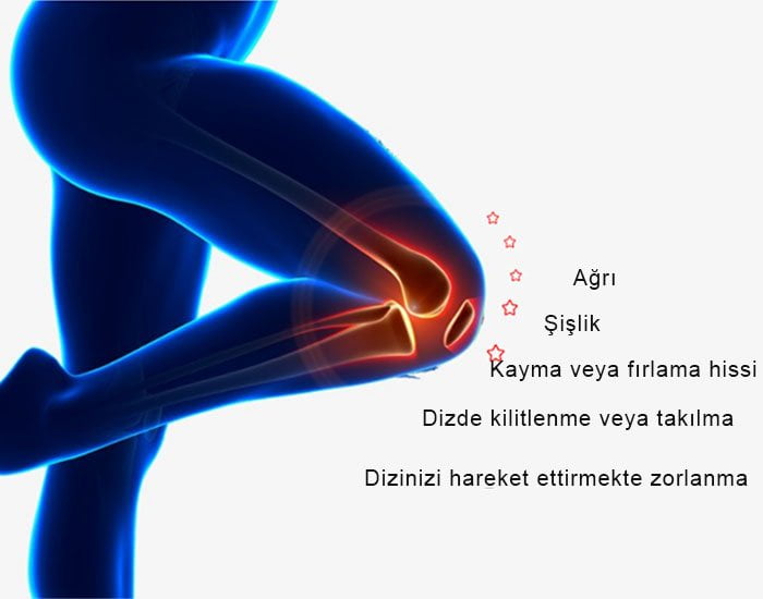 Menisküs Yırtığı Ameliyatsız Tedavi