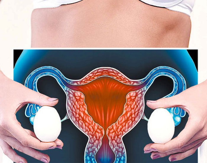 Menopozda Yumurtalık Kisti Tedavisi