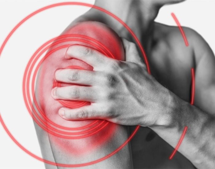 Omuz Tendon Yırtığı Belirtileri Ve Tedavisi