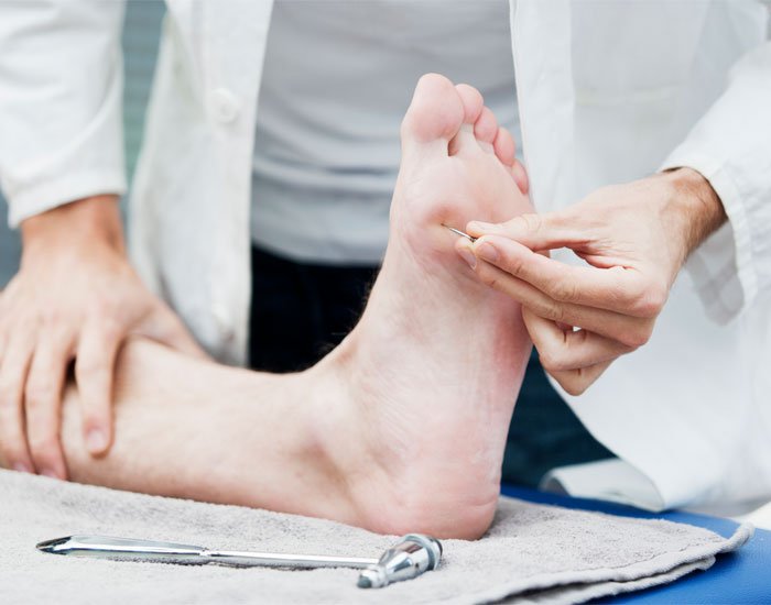 Periferik Nöropati Alternatif Tedavi