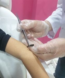 Sülük İle Basur ve Hemoroid Tedavisi