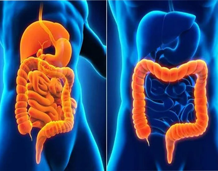 Ülseratif Kolit Nedir Nedenleri Belirtileri Ve Tedavisi